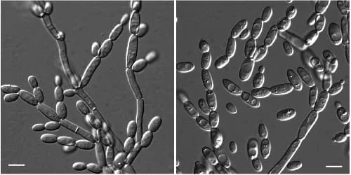Đa Dạng Di Truyền Phân Tử Của Nấm Men Moniliella Tại Việt Nam